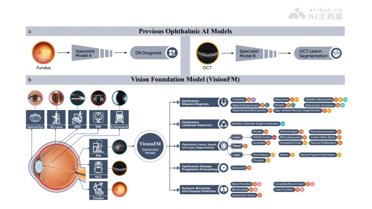 VisionFM – 通用眼科AI大模型，具备少样本多种疾病诊断能力插图