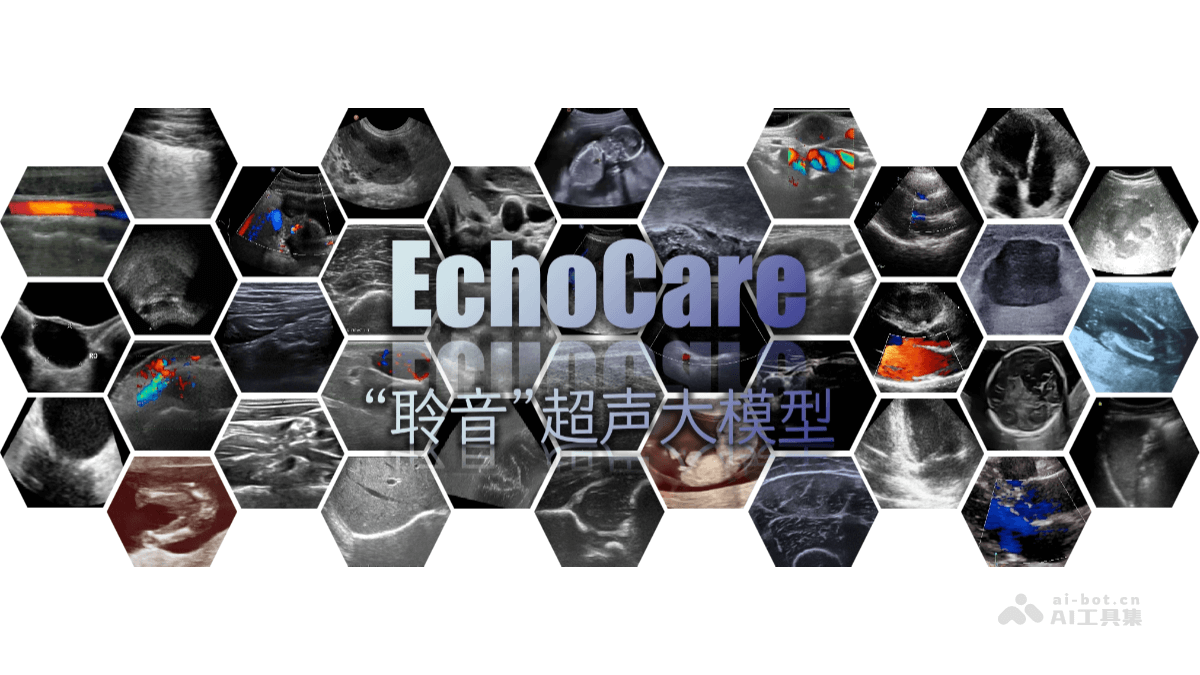 聆音EchoCare – 香港中科院推出的超声大模型插图